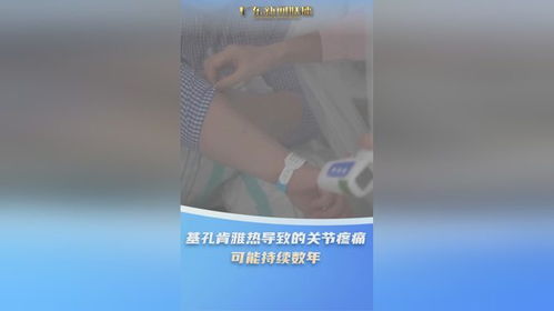 出现这些症状可能是基孔肯雅热出现这些症状可能是基孔肯雅热